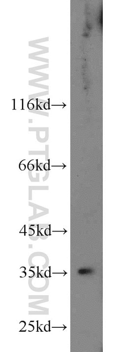 HSD17B2 Rabbit anti-Human, Polyclonal, Proteintech:Antibodies:Primary Antibodies
