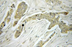 MRPS22 Rabbit anti-Human, Mouse, Rat, Polyclonal, Proteintech:Antibodies:Primary