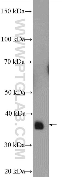 MRPS22 Rabbit anti-Human, Mouse, Rat, Polyclonal, Proteintech:Antibodies:Primary