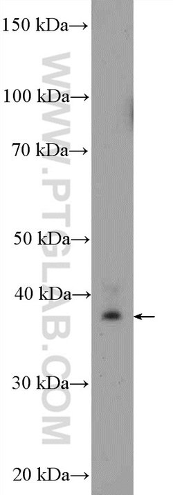 MRPS22 Rabbit anti-Human, Mouse, Rat, Polyclonal, Proteintech:Antibodies:Primary