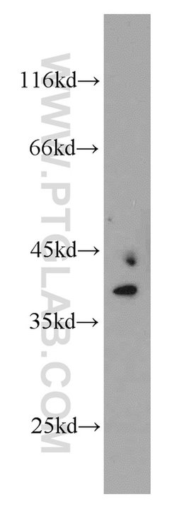 MRPS22 Rabbit anti-Human, Mouse, Rat, Polyclonal, Proteintech:Antibodies:Primary