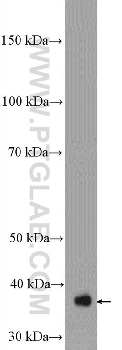 MRPS22 Rabbit anti-Human, Mouse, Rat, Polyclonal, Proteintech:Antibodies:Primary
