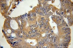 BID Rabbit anti-Human, Polyclonal, Proteintech:Antibodies:Primary Antibodies