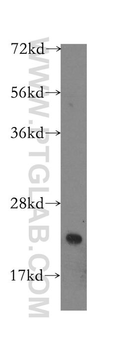 BID Rabbit anti-Human, Polyclonal, Proteintech:Antibodies:Primary Antibodies