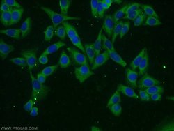 VILIP 3 Rabbit anti-Human, Mouse, Polyclonal, Proteintech:Antibodies:Primary