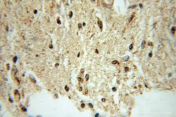 VILIP 3 Rabbit anti-Human, Mouse, Polyclonal, Proteintech:Antibodies:Primary