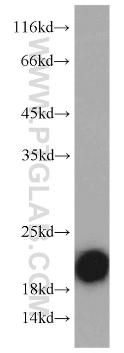 VILIP 3 Rabbit anti-Human, Mouse, Polyclonal, Proteintech:Antibodies:Primary