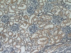 VILIP 3 Rabbit anti-Human, Mouse, Polyclonal, Proteintech:Antibodies:Primary