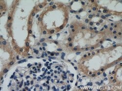 VILIP 3 Rabbit anti-Human, Mouse, Polyclonal, Proteintech:Antibodies:Primary
