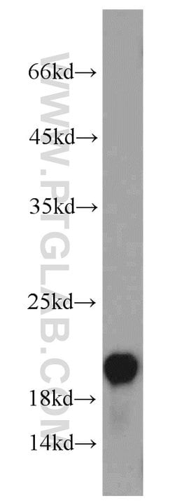 VILIP 3 Rabbit anti-Human, Mouse, Polyclonal, Proteintech:Antibodies:Primary