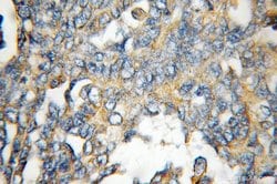 FHL1 Rabbit anti-Human, Mouse, Zebrafish, Polyclonal, Proteintech 150 &mu;L;