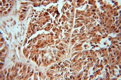 FHL1 Rabbit anti-Human, Mouse, Zebrafish, Polyclonal, Proteintech 150 &mu;L;