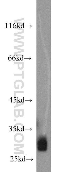 FHL1 Rabbit anti-Human, Mouse, Zebrafish, Polyclonal, Proteintech 150 &mu;L;