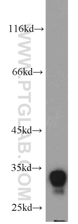 FHL1 Rabbit anti-Human, Mouse, Zebrafish, Polyclonal, Proteintech 150 &mu;L;