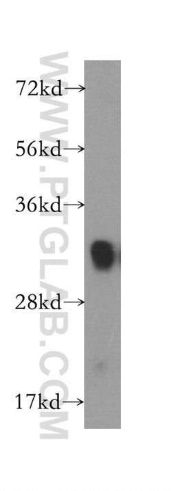 FHL1 Rabbit anti-Human, Mouse, Zebrafish, Polyclonal, Proteintech 150 &mu;L;