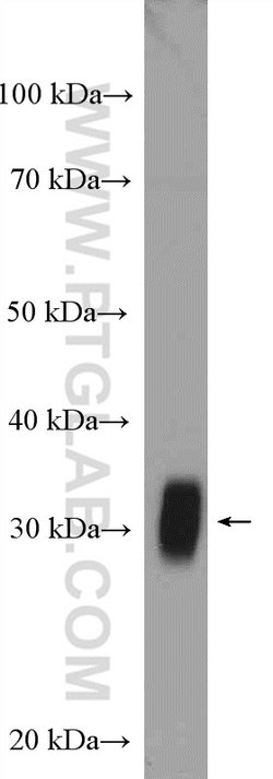 FHL1 Rabbit anti-Human, Mouse, Zebrafish, Polyclonal, Proteintech 150 &mu;L;