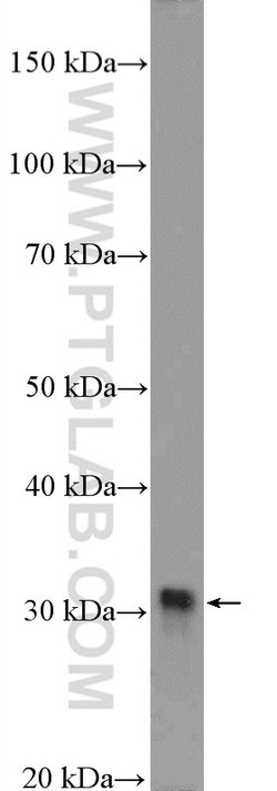 FHL1 Rabbit anti-Human, Mouse, Zebrafish, Polyclonal, Proteintech 150 &mu;L;
