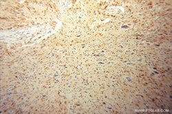 CSNK2A1 Rabbit anti-Human, Mouse, Rat, Polyclonal, Proteintech:Anticorps:Anticorps