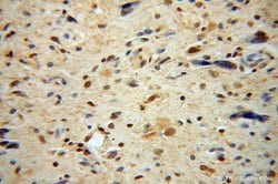 CSNK2A1 Rabbit anti-Human, Mouse, Rat, Polyclonal, Proteintech:Anticorps:Anticorps