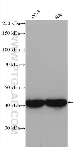 CSNK2A1 Rabbit anti-Human, Mouse, Rat, Polyclonal, Proteintech:Anticorps:Anticorps