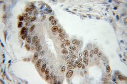 CSNK2A1 Rabbit anti-Human, Mouse, Rat, Polyclonal, Proteintech