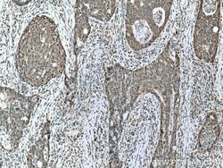 CSNK2A1 Rabbit anti-Human, Mouse, Rat, Polyclonal, Proteintech:Anticorps:Anticorps