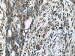 CSNK2A1 Rabbit anti-Human, Mouse, Rat, Polyclonal, Proteintech:Anticorps:Anticorps