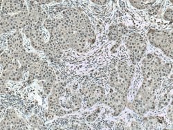 CSNK2A1 Rabbit anti-Human, Mouse, Rat, Polyclonal, Proteintech:Anticorps:Anticorps