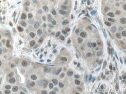 CSNK2A1 Rabbit anti-Human, Mouse, Rat, Polyclonal, Proteintech:Anticorps:Anticorps