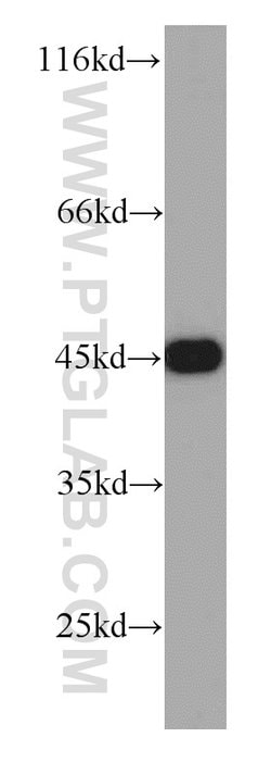 CSNK2A1 Rabbit anti-Human, Mouse, Rat, Polyclonal, Proteintech:Anticorps:Anticorps