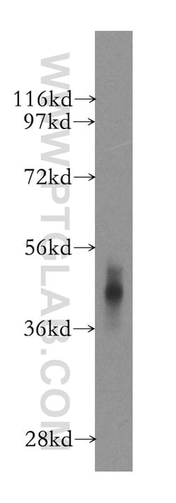 CSNK2A1 Rabbit anti-Human, Mouse, Rat, Polyclonal, Proteintech:Anticorps:Anticorps
