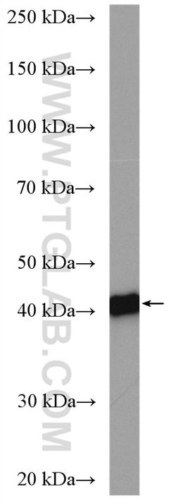 CSNK2A1 Rabbit anti-Human, Mouse, Rat, Polyclonal, Proteintech:Anticorps:Anticorps