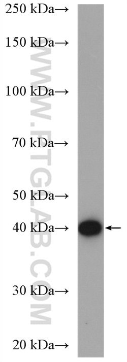 CSNK2A1 Rabbit anti-Human, Mouse, Rat, Polyclonal, Proteintech:Anticorps:Anticorps