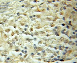 SMARCD1 Rabbit anti-Human, Mouse, Rat, Polyclonal, Proteintech 150 &mu;L;