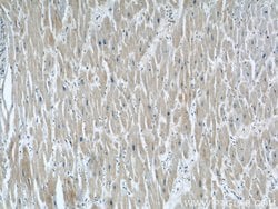 RAB32 Rabbit anti-Human, Polyclonal, Proteintech 20 &mu;L; Unconjugated:Antibodies,