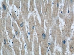 RAB32 Rabbit anti-Human, Polyclonal, Proteintech 20 &mu;L; Unconjugated:Antibodies,