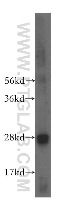 RAB32 Rabbit anti-Human, Polyclonal, Proteintech 20 &mu;L; Unconjugated:Antibodies,