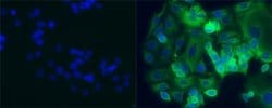 Mouse IgG1 kappa Isotype Control (P3.6.2.8.1), FITC, eBioscience , Invitrogen