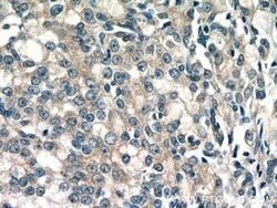 MIPEP Rabbit anti-Human, Polyclonal, Proteintech:Antibodies:Primary Antibodies