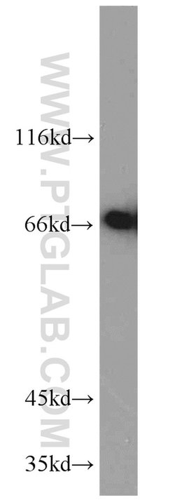 MIPEP Rabbit anti-Human, Polyclonal, Proteintech:Antibodies:Primary Antibodies