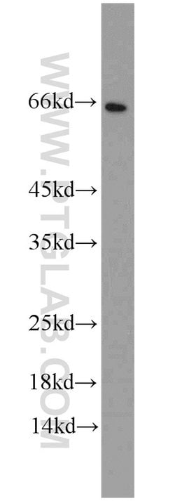 CDK5RAP3 Rabbit anti-Human, Polyclonal, Proteintech 20 &mu;L | Buy Online | Proteintech | Fisher Scientific
