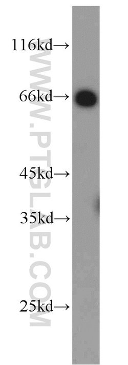 CDK5RAP3 Rabbit anti-Human, Polyclonal, Proteintech 20 &mu;L | Buy Online | Proteintech | Fisher Scientific