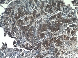 Midkine Rabbit anti-Human, Polyclonal, Proteintech:Antibodies:Primary Antibodies