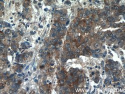 Midkine Rabbit anti-Human, Polyclonal, Proteintech:Antibodies:Primary Antibodies
