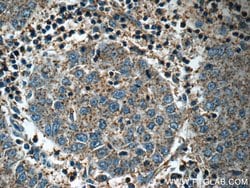Midkine Rabbit anti-Human, Polyclonal, Proteintech:Antibodies:Primary Antibodies