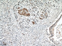 Midkine Rabbit anti-Human, Polyclonal, Proteintech:Antibodies:Primary Antibodies
