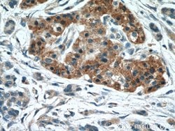 Midkine Rabbit anti-Human, Polyclonal, Proteintech:Antibodies:Primary Antibodies