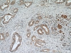 Midkine Rabbit anti-Human, Polyclonal, Proteintech:Antibodies:Primary Antibodies