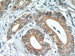 Midkine Rabbit anti-Human, Polyclonal, Proteintech:Antibodies:Primary Antibodies