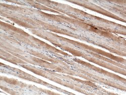 Dystroglycan Rabbit anti-Human, Mouse, Rat, Polyclonal, Proteintech:Antibodies:Primary